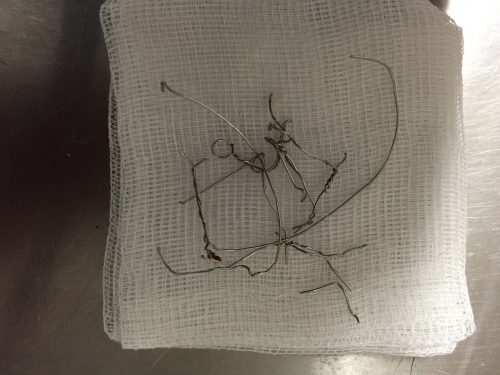 suture inox